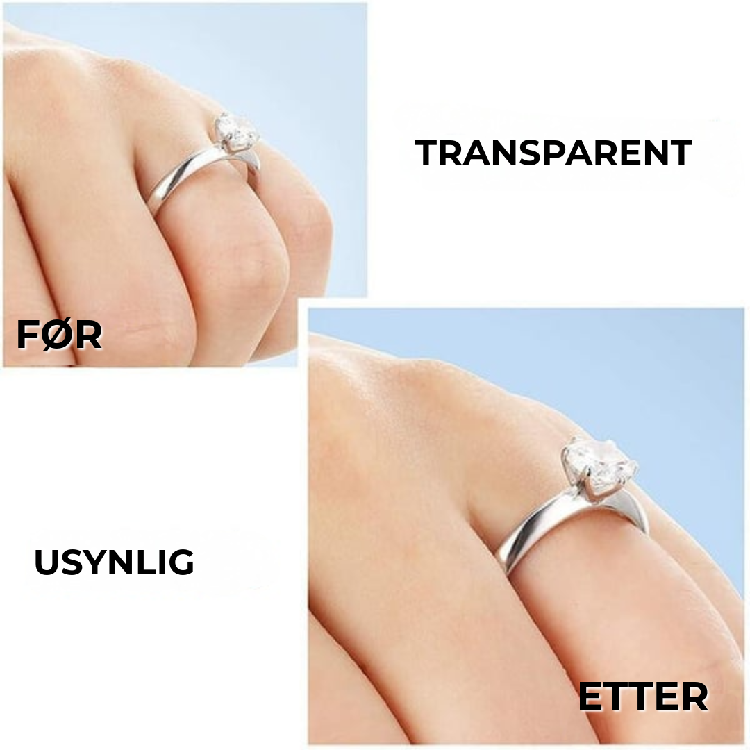 RingFix™ | ringreduserer