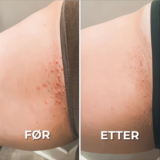 Profesjonell Barbermaskin