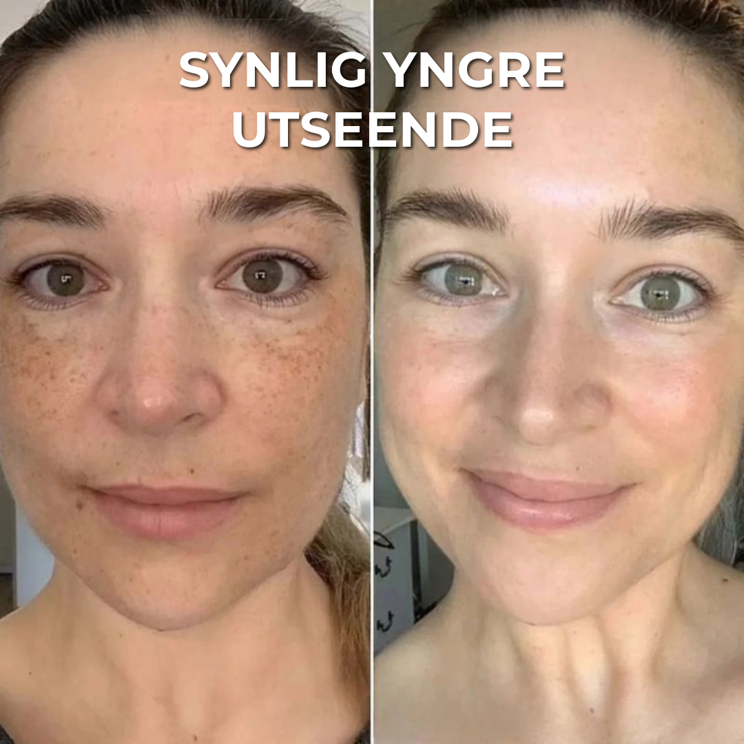 Lumeor™ Kollagenmaske