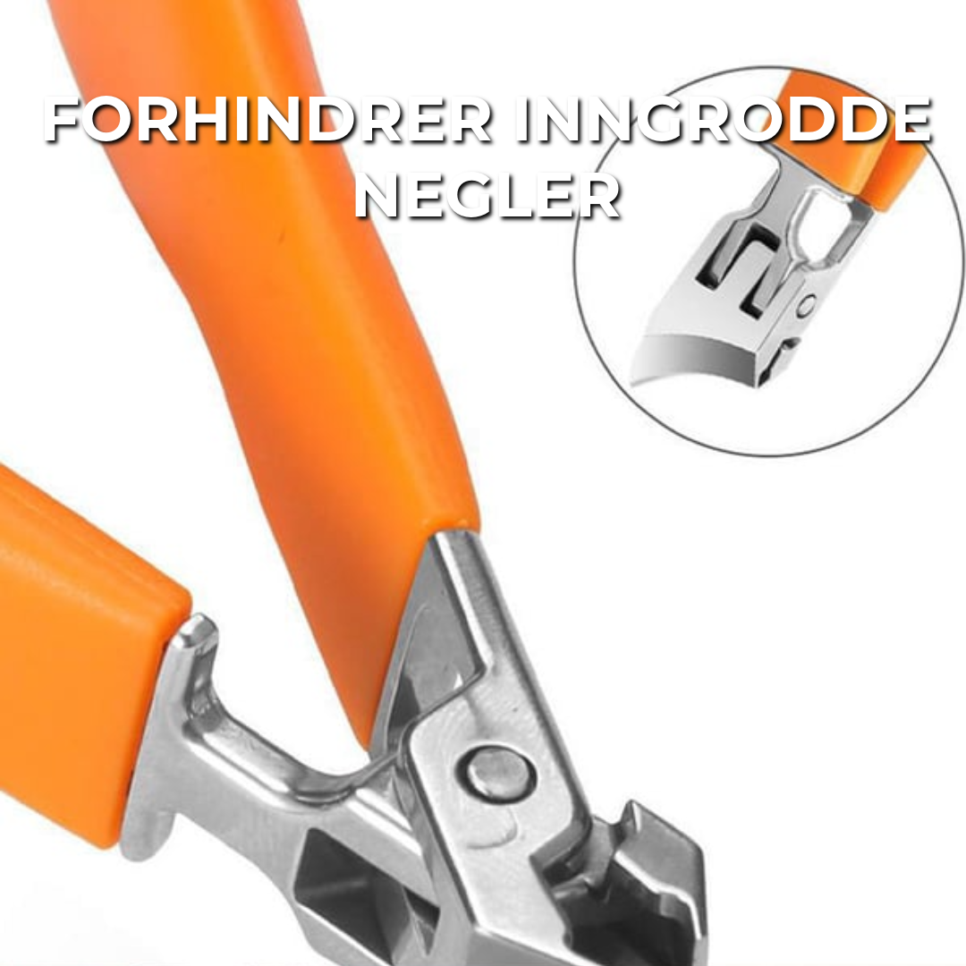 Anti-Negl-Inngroing Klipper