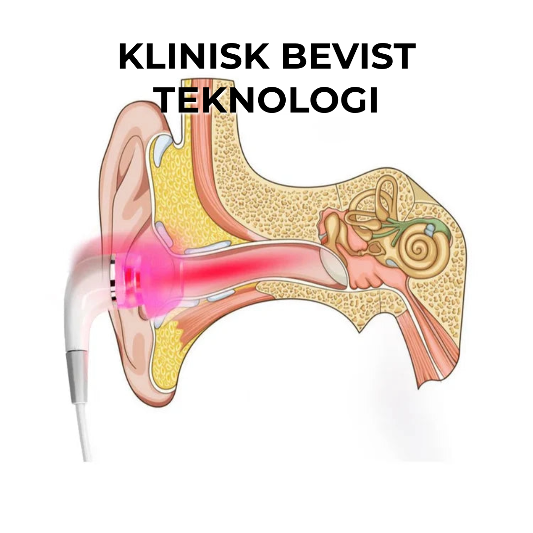 Tinnitus Laserterapi