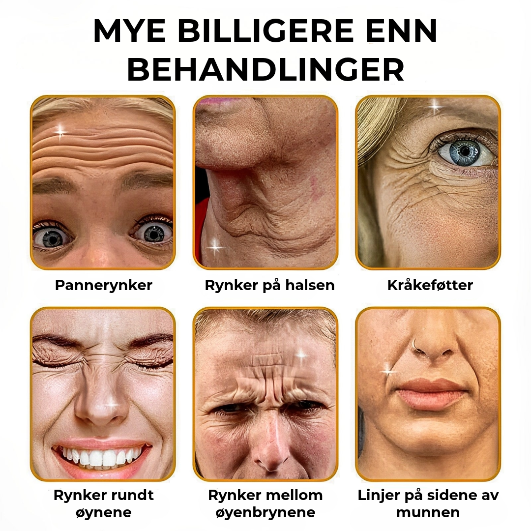 BOTOX™ Anti-ryngekrem